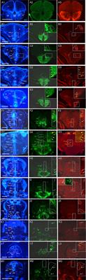 Adult islet1 Expression Outlines Ventralized Derivatives Along Zebrafish Neuraxis